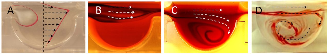 Physical models of the embryonic heart with dye